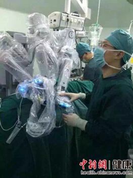 第一例機器人輔助冠脈搭橋手術成功完成